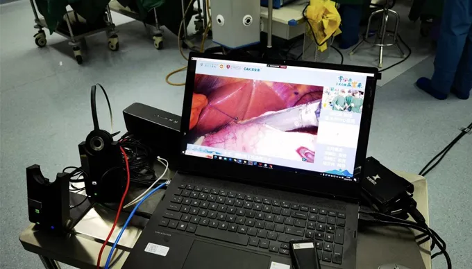 Las grapadoras quirúrgicas CAK Bren seis cirugías vivas en China